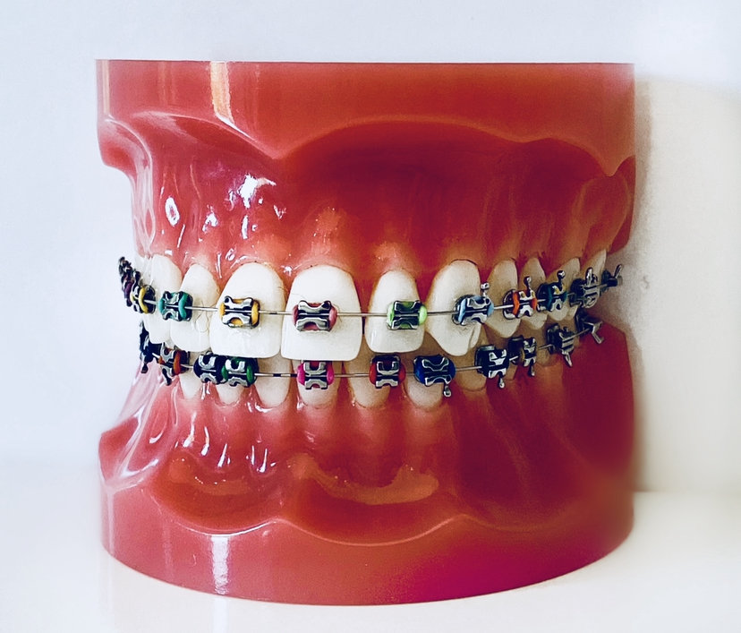 red colored braces